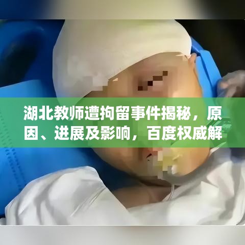 湖北教師遭拘留事件揭秘，原因、進(jìn)展及影響，百度權(quán)威解讀！