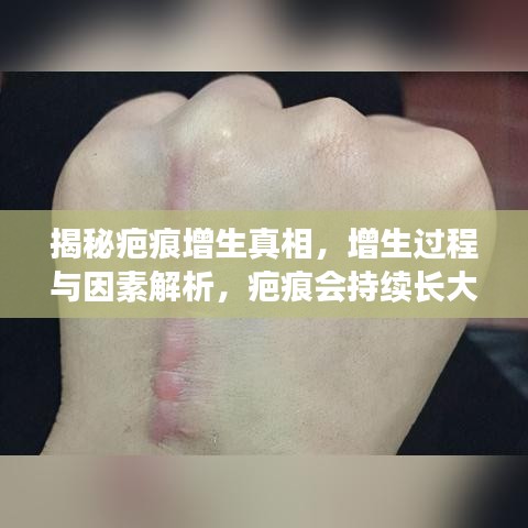 揭秘疤痕增生真相，增生過程與因素解析，疤痕會持續(xù)長大嗎？