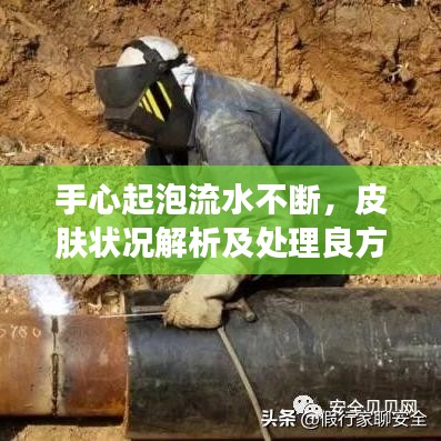 手心起泡流水不斷，皮膚狀況解析及處理良方