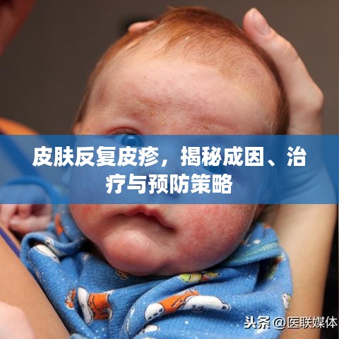 皮膚反復(fù)皮疹，揭秘成因、治療與預(yù)防策略